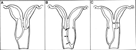 the canal in the female that extends from the external genitalia (vulva) to the cervix uteri. . Doube vaginal